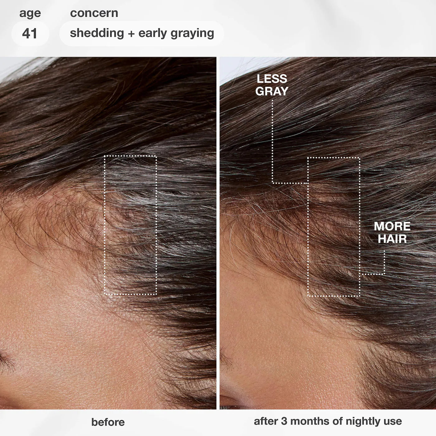 FutureIQ™ Hair Longevity Serum for Graying, Thinning, & Scalp Aging