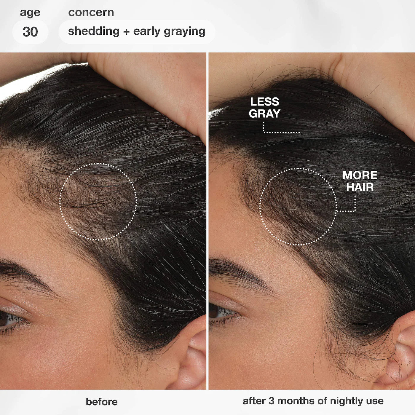 FutureIQ™ Hair Longevity Serum for Graying, Thinning, & Scalp Aging