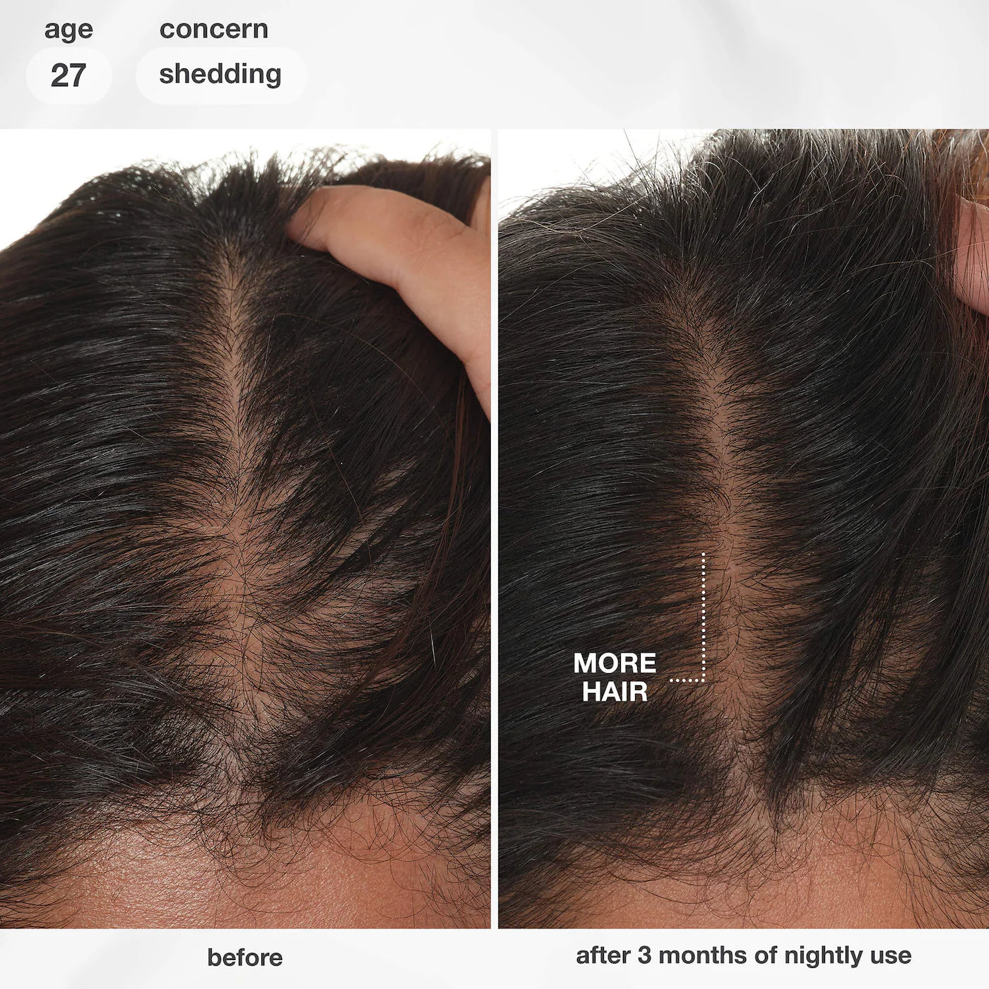 FutureIQ™ Hair Longevity Serum for Graying, Thinning, & Scalp Aging